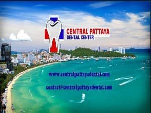 Pattaya Smile Dental Clinic - Banglamung