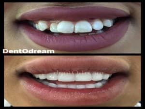 DentOdream / Dental Dream Turkey