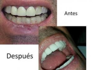 Sonrisa Perfecta Dental-Tarsys Loayza Roys