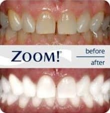 Ballestero Dental Care