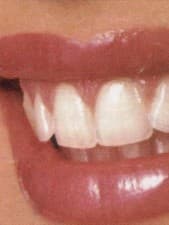 Split Dent Dental Care