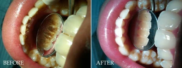 Dr.Aboul Azayem for prothodontics and implant