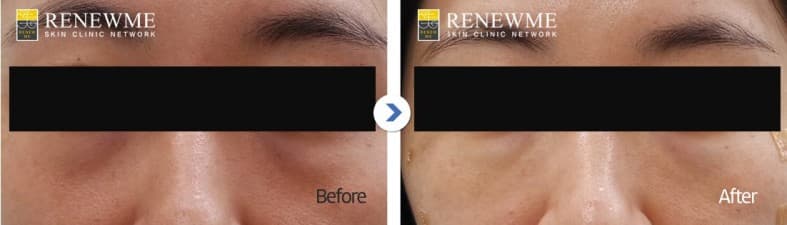 Renewme Skin Clinic