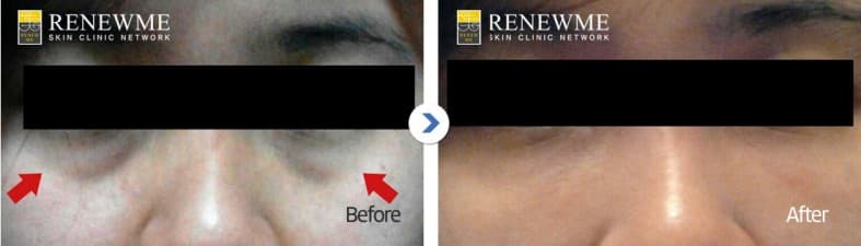 Renewme Skin Clinic Dongdaemun