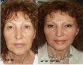 Compare Reviews, Prices & Costs of Gnathology Treatment in Egypt at Time Plastic | M-EG1-19