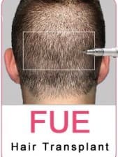 Compare Reviews, Prices & Costs of Platelet Rich Plasma (PRP) Facial Treatment in Faridabad at Dr. Devesh Aggarwal | M-IN5-4