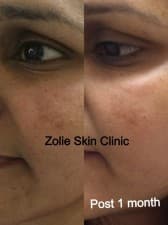 Zolie Skin Clinic - Delhi
