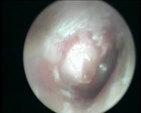 ENT, Head, Neck clinic and hearing aid centre