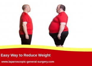 Compare Reviews, Prices & Costs of Gastroscopy in Bangalore at General and Laparoscopic Surgery India | M-IN1-38