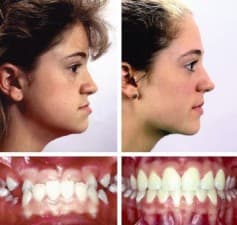 Compare Reviews, Prices & Costs of Laser Hair Removal in Bangalore at Health Cottage Hospital (MultiSpeciality) | M-IN1-48