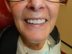 Compare Reviews, Prices & Costs of Maxillofacial Prosthetics in Mexico at Sol Dental Group | M-ME5-23