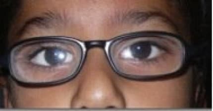 See & Smile Eye Care