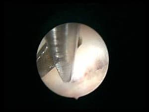 Mr Ioannis Douliotis MBBS MRCOG DFFP