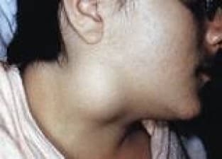 Laparoscopic Surgery Hospital Bangalore