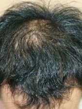 Dr. Shin-Je Lee (Dr. Momo) Hair Transplant International