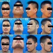 Glojas Hair Transplant Center