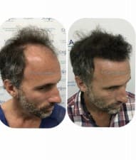 Capilea Centro Medico Capilar