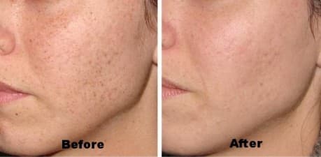 OFF Skin & Laser Clinic