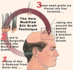 Ardem Free Consultancy Hair Clinic