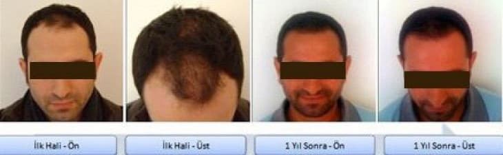 Get Hair -  Hair Transplant Professionals