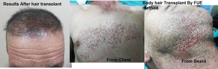 South Delhi Cosmetic Clinic