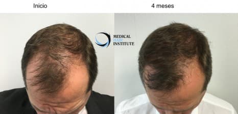 Medical Hair Institute