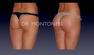 Dr Sebastiano Montoneri-Cosmetic and Plastic Surgery