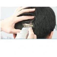 DR. Moh Plastic Surgery Hair Transplantation Center