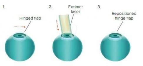 Optegra Eye Health Care Birmingham