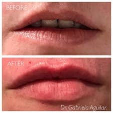 Compare Reviews, Prices & Costs of Rhinoplasty in West Yorkshire at Dr. Gabriela Aguilar - Leeds | M-UN1-1059