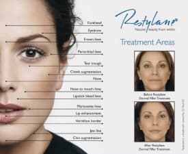 Compare Reviews, Prices & Costs of Arm Liposuction in Nottinghamshire at Medical Cosmetics Ltd | M-UN1-1060