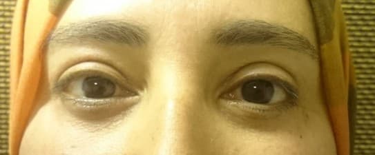 Dr. Ashraf Abolfotooh Plastic & Reconstructive Surgery Clinic