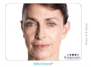 Compare Reviews, Prices & Costs of Facelift in Northamptonshire at Indulgence Skin Laser and Beauty Clinic | M-UN1-1114