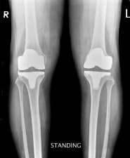 Joint Replacement & Sports injury Clinic