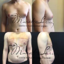 Assoc. Prof. Murat Sarıcı