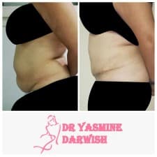 Yasmine Darwish plastic surgery clinic