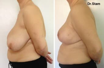 Dr.Stam Plastic Surgery