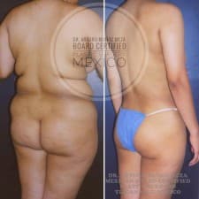 Hospital Angeles Dr. Arturo Muñoz Meza Plastic Surgery