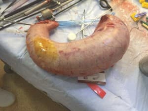 Compare Reviews, Prices & Costs of Endometriosis Treatment in Egypt at Weightloss Clinic | M-EG1-132