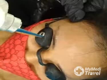 Chiang Rai Tattoo Removal Shop