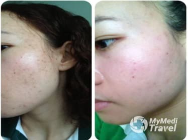 Dr.Nittaya Skin Clinic Pak Kret