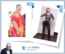 Dr Manuel Garcia - Bariatric Surgeon