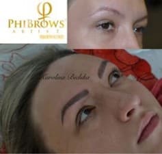 Compare Reviews, Prices & Costs of Skin Tag (Acrochordon) Removal in Dublin at InkArt Microblading | M-DI-79