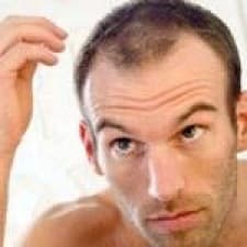 SO-EP Cerrahi Saç Ekimi ve Lazer Merkezi