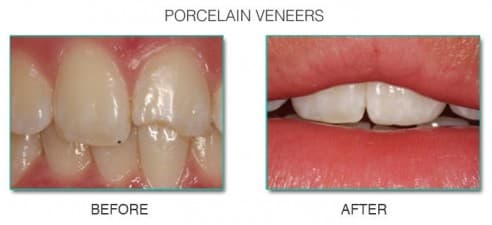 Guatemala Dental Team