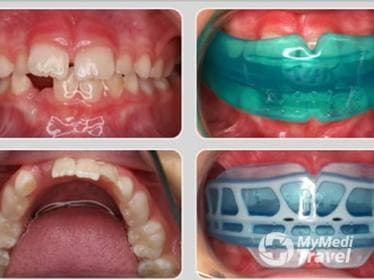 Compare Reviews, Prices & Costs of Pediatric Dentistry in Agusan del Sur at Dr. Adelaida A. Oraiz | M-P3-1