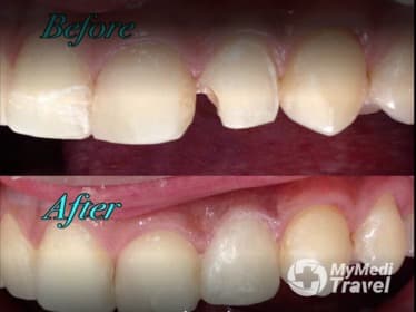 Compare Reviews, Prices & Costs of Dental CT Scan in Camarines Norte at Confi-dent Family Dental Care | M-P19-2