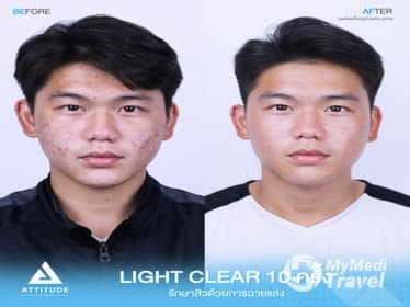 ATTITUDE CLINIC เชียงราย