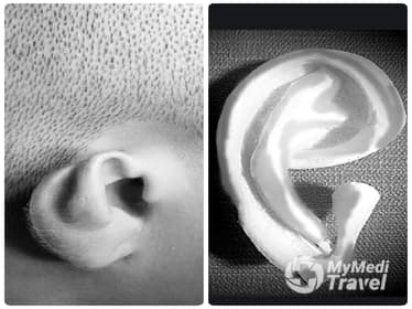 Dr Ivy Tangco Ears Nose Throat Facial Plastic surgery