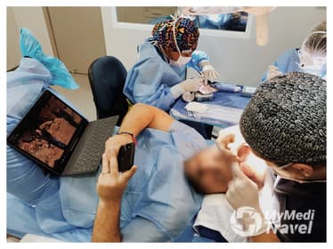 Compare Reviews, Prices & Costs of Beard Transplant in Panama at DHI Panama | 5BFF46